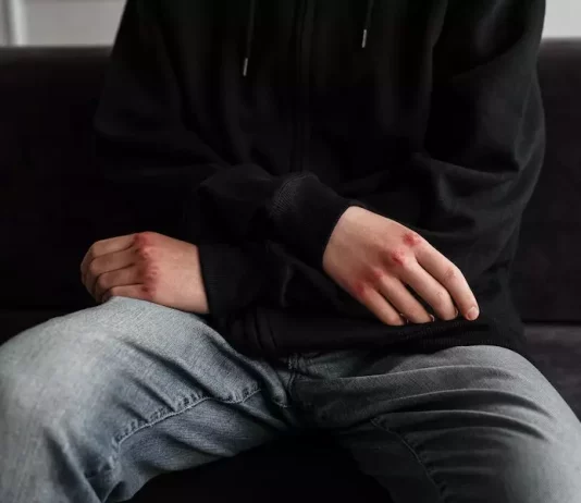 Types Of Compensation In A Personal Injury Case Types Of Compensation In A Personal Injury Case