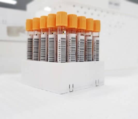 Starting A Pathology Center On A Shoestring Budget: Essential Tips And Strategies The Importance Of Buying A Reliable And Safe Car